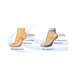 Ing Source Orthosleeve Foot Sleeve