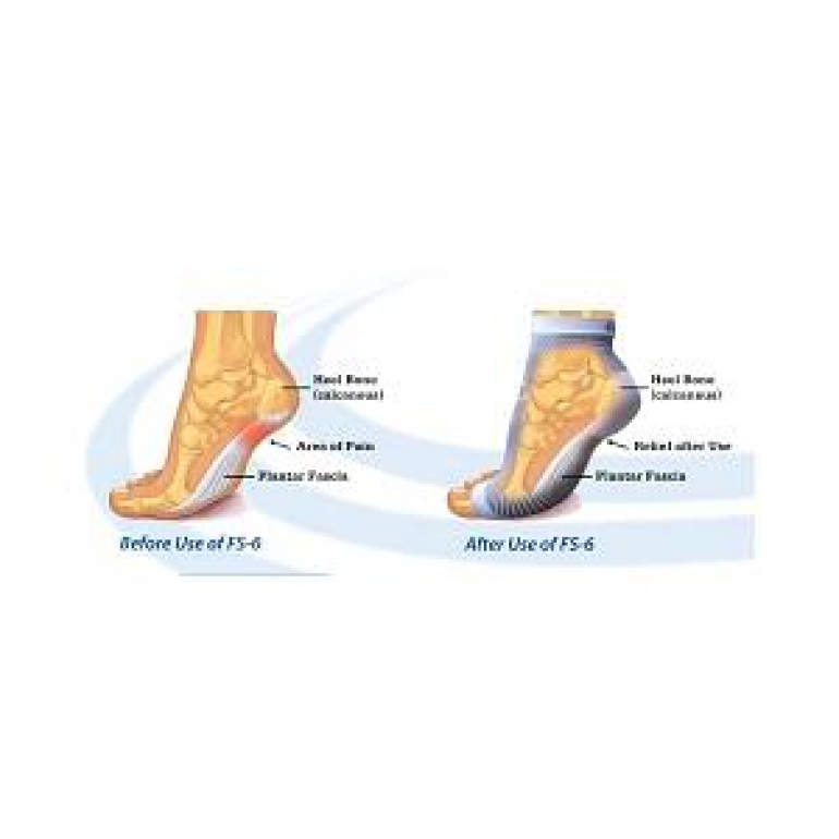 Ing Source Orthosleeve Foot Sleeve