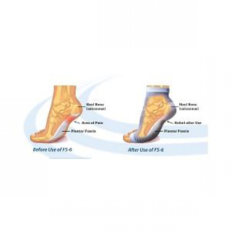 Ing Source Orthosleeve Foot Sleeve