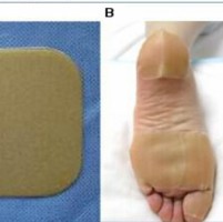 Category Image for Hydrocolloid/Transparent Dressing